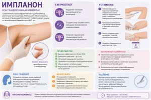 Импланон: что важно знать о контрацептивном импланте