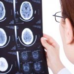 Brain atrophy: causes, classification and stages