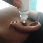 Drops are put into a girl&#39;s ear