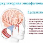 Дисциркуляторная энцефалопатия