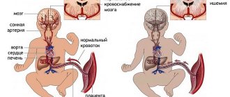 Fetal hypoxia
