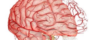 Гипоплазия сосудов головного мозга
