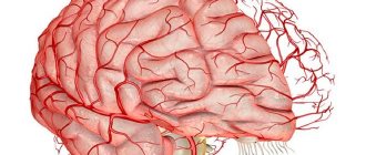 Hypoplasia of cerebral vessels