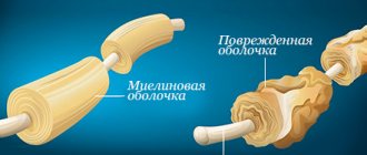 Changes in nerve fibers during sclerosis
