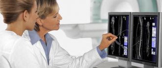 A radiologist examines MRI images.