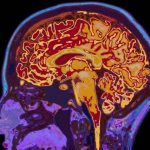 Красные ядра среднего мозга: строение, функции и особенности