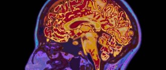 Красные ядра среднего мозга: строение, функции и особенности