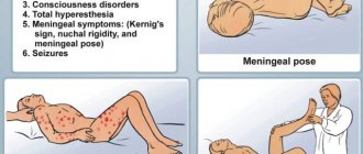 менингиальные симптомы