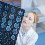 МРТ при сотрясении головного мозга