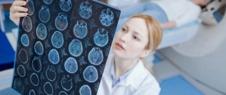 МРТ при сотрясении головного мозга
