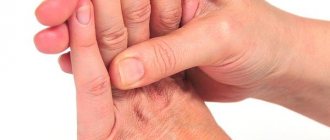 Немеет мизинец и безымянный палец: причины, возможные заболевания и лечение