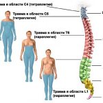 Spinal cord membranes