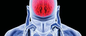 cerebral edema due to stroke