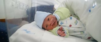 Facial nerve paresis: central and peripheral symptoms in a newborn