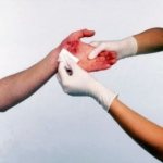 First aid for injuries