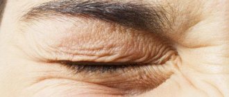 why does the left eye twitch? signs of the lower eyelid