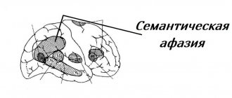 Brain circuitry in semantic aphasia