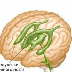 structure of the ventricles