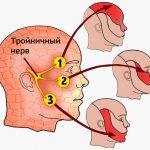 Trigeminal nerve. Symptoms of inflammation and treatment, medications, folk remedies 