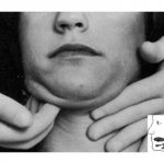 Inflammation of the jaw nerve: symptoms, diagnosis, treatment