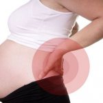 Защемление седалищного нерва при беременности симптомы и лечение