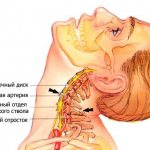 Toothache radiates to the head: temple, jaw, ear, eye