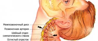 Toothache radiates to the head: temple, jaw, ear, eye